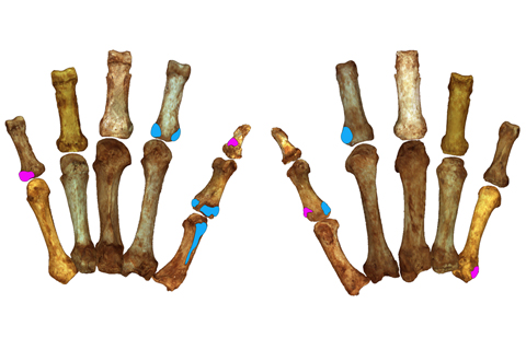 Vor weißem Hintergrund sind die bräunlichen, fossilen Fingerknochen zweier Hände zu sehen, an denen farbige Markierungen angebracht sind